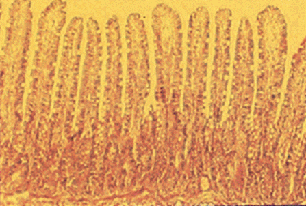 腸粘膜